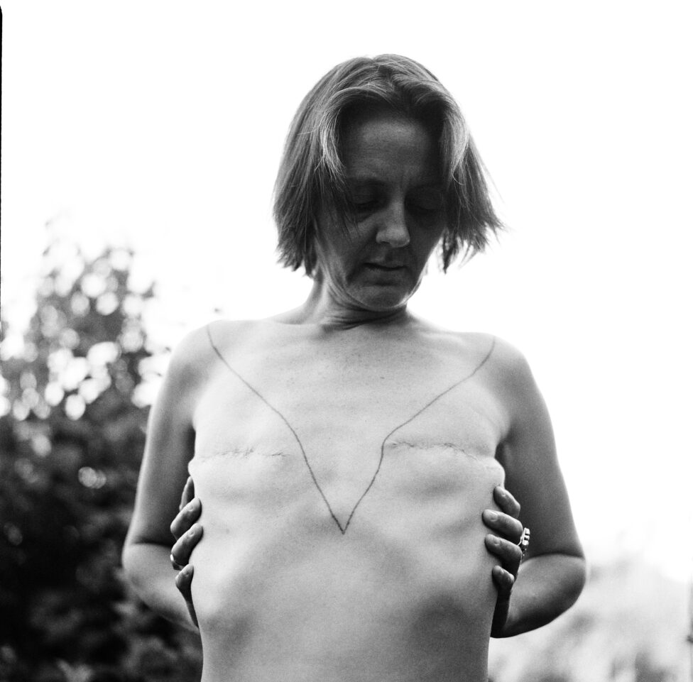 2 months post DMX. Jmy by Elizabeth Herring